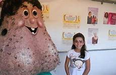 testicle nutsack cancer mascot balls giant mr cursed promote creates brazil research prev