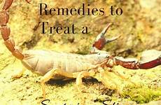 scorpion sting remedies treat bites