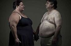 obesity overweight hormonales desequilibrios causes obeses obese does peso mujeres erectile dysfunction adipositas likely lordosis lombafit afectan personnes obèses getty