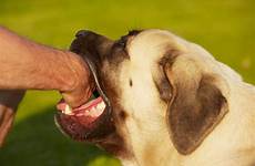 animal bites bite dog dogs rabies attack center severe