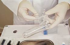 gynecological exams gynecology happen should guide shouldn