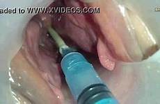sperm injection syringe uterus semen injected womb insertion xvideos