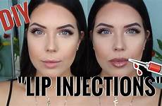 lip lips injections huge diy