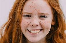 ginger freckles stocksy