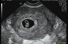 ultrasound weeks days