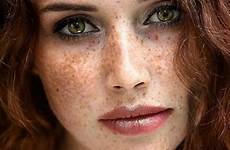 freckled freckles redheads