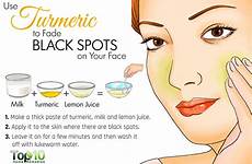 spots remedies turmeric face dark rid oil facts women tips blackspots go week gif