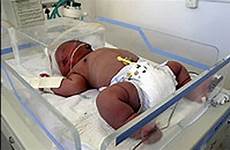 newborn heaviest birth babies santos 17lb iluminasi
