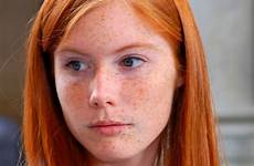 redhead freckles redheads braces gorgeous refrence freckle mostly sommersprossen