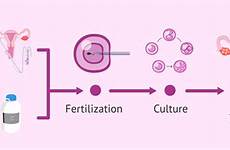 ivf sperm donor fiv donante semen donation invitra samenspende embryo proceso rates