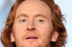 ginger famous redhead curran tony scots kiss celebrate