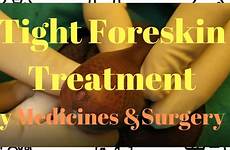 foreskin tight circumcision surgery treatment