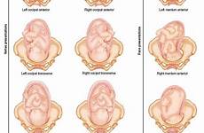 fetal womb pregnancy birth positioning midwifery maternity breech dilation school midwife