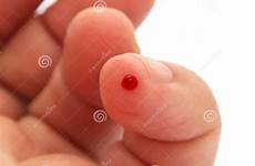 bleeding finger hand isolated background pr preview stock dreamstime