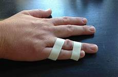 pinky taped pinkie taping injured verywellhealth jammed ringfinger verbindet dislocation kleinen which mignolo neighbor fractures zusammen kleben