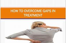 gaps overcome treatment presentation ppt powerpoint