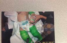 injured baby mom boyfriend