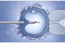 sperm injection intracytoplasmic sections expert