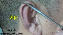 耳郭的剖部位-耳轮