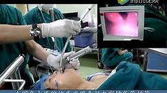 可视气管插管内窥镜医院操作培训视频