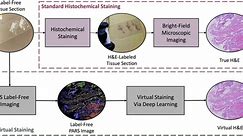 Researchers create an AI-powered digital imaging system to speed up cancer biopsy results