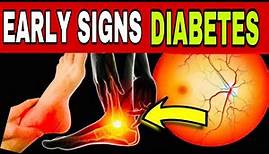 14 EARLY and DANGEROUS SIGNS of DIABETES (High Blood Sugar)
