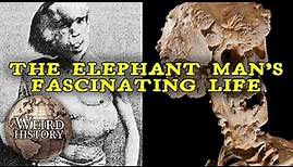 The Elephant Man | The Weird & Tragic Story of Joseph Merrick