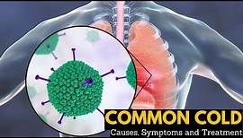 Common Cold, Causes, Signs and Symptoms, Diagnosis and Treatment.