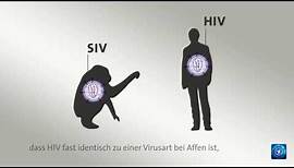 AIDS: Woher stammt HIV?