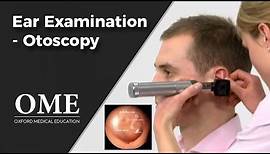 Otoscopy (Ear Examination) - ENT