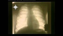 Der Röntgenfilm - Ein Dokumentar- und Lehrfilm der auf der Biennale in Venedig 1937 prämiert wurde