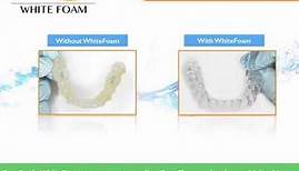 EverSmile WhiteFoam Cleans Candid Co., Smile Direct Club, and Invisalign and Retainers On-The-Go!
