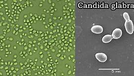 Candida glabrata- An Overview