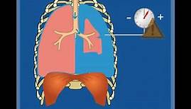 Loch in der Lunge (Ventilpneumothorax) – Grundlagen / Thoraxdrainage für Einsteiger