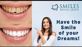 How to transform your Smile with Cosmetic Dentistry (2021)