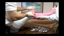 Application Long Leg Cast | Fiberglass Medical Leg Cast