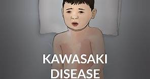 "Kawasaki Disease" by Lucy Rubin and Lisa DiPietro, MD for OPENPediatrics