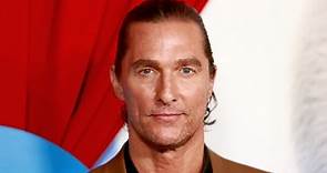Matthew McConaughey reflects on hair transformation after developing ‘baseball-sized bald spot’