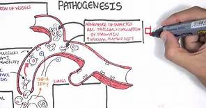 Malaria Pathophysiology