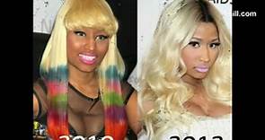 Nicki Minaj Plastic Surgery Over The Years. The Before & After Pictures!
