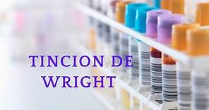 Tinción de Wright: preparación, principio, procedimiento