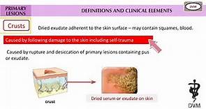 Skin Lesions | Papule | Pastule | Nodule | Crusts |Types of skin lesions | Dermatology