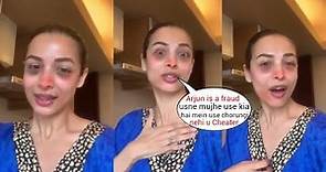 Malaika Arora's shocking Live on Arjun Kapoor her Breakup & Arbaaz Khan's 2nd Marriage with Shura