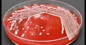 Bacterial Colony Description
