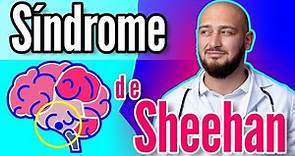 Sindrome de Sheehan - Dr. Mario Vega Carbó.