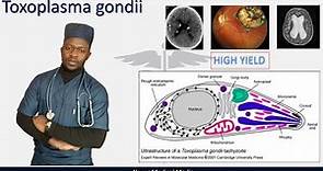 Toxoplasma gondii | Toxoplasmosis clinical features, diagnosis and treatment