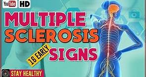 16 Multiple Sclerosis Symptoms Early Warning Signs