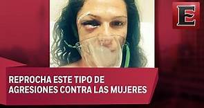 “Me golpearon de una forma cobarde”: Ana Gabriela Guevara