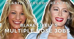 Blake Lively Plastic Surgery: Plastic Surgeon Reacts to Gossip Girl Nose Jobs
