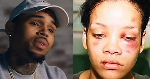 Chris Brown Details Rihanna Assault: She Tried To Kick Me, I Bit Her Arm